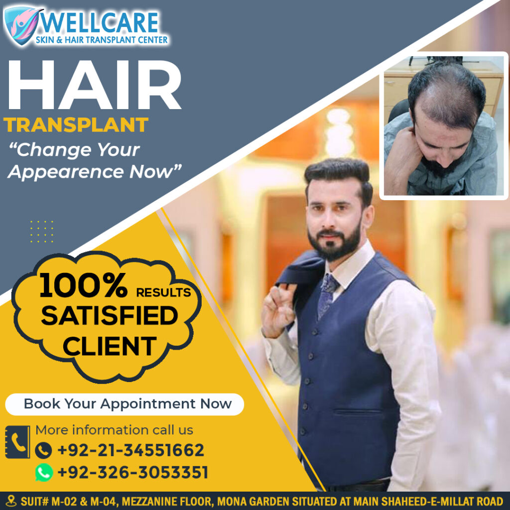 Before and after result at Wellcare