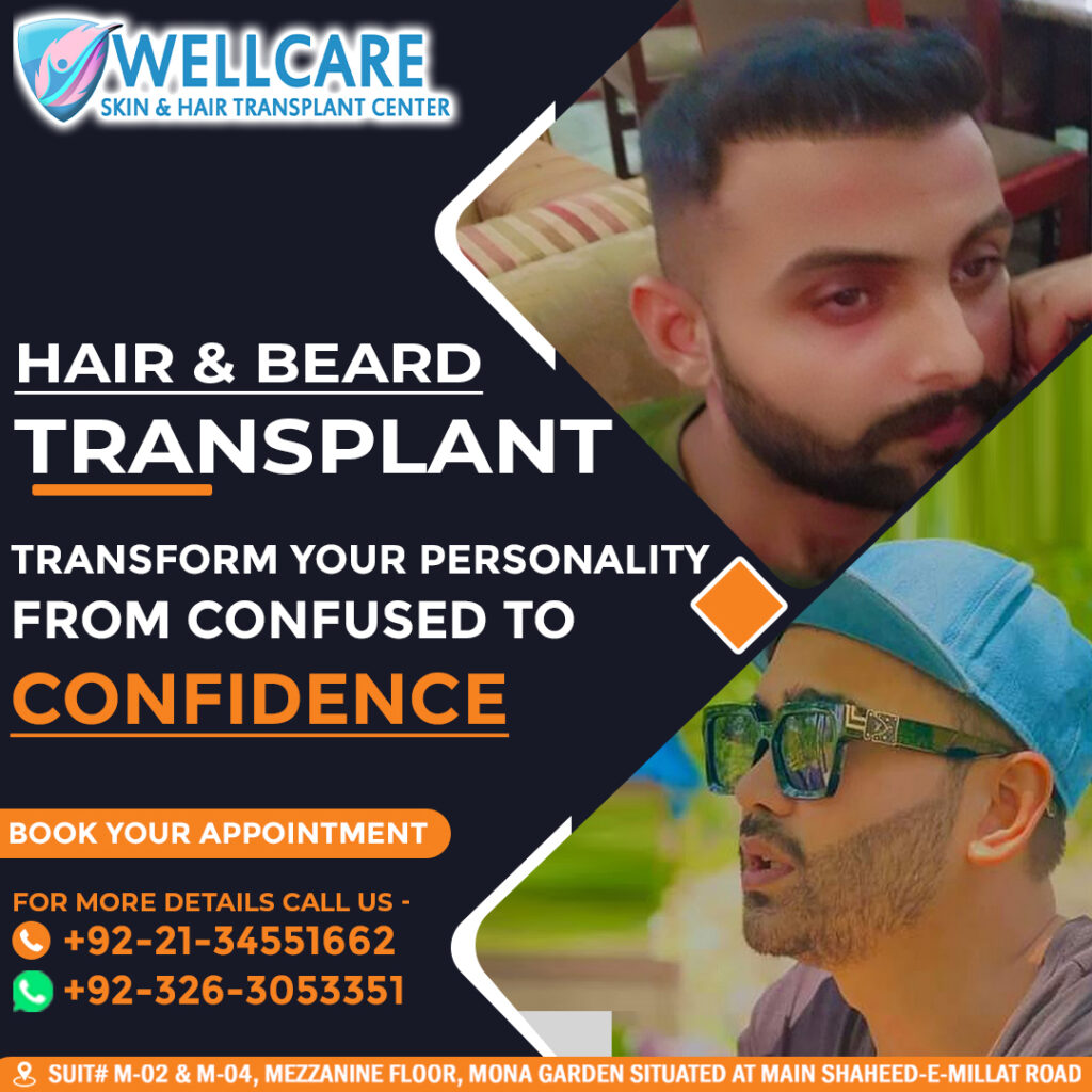 Before and after result at Wellcare