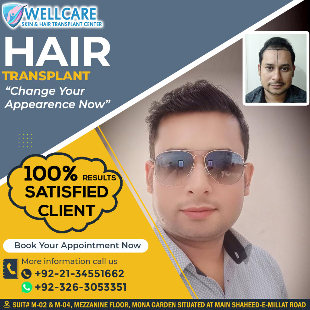 Before and after result at Wellcare