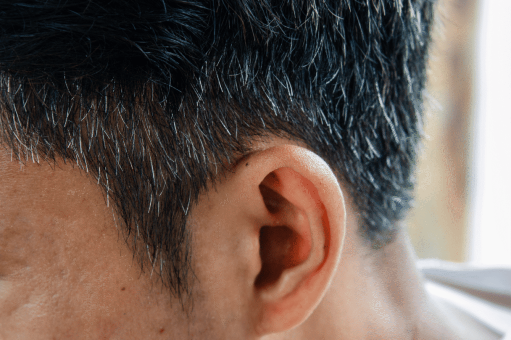 Men's Guide: Does Hair Transplant Hair Go Grey?