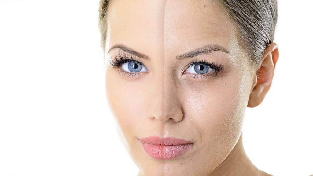 PRGF Treatment PRGF Treatment