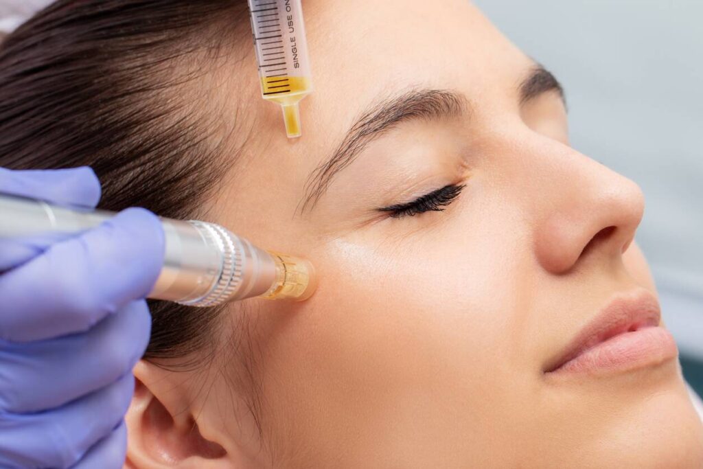 PRP - Platelet-Rich Plasma Therapy