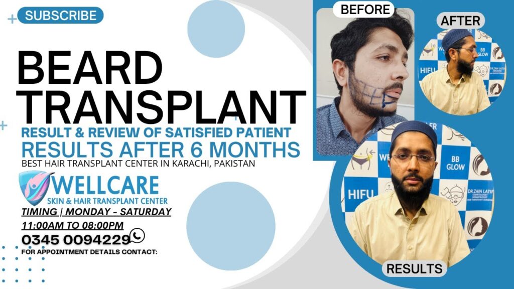 Before and after result at Wellcare